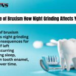 Illustration of dental damage caused by night-time teeth grinding (bruxism)